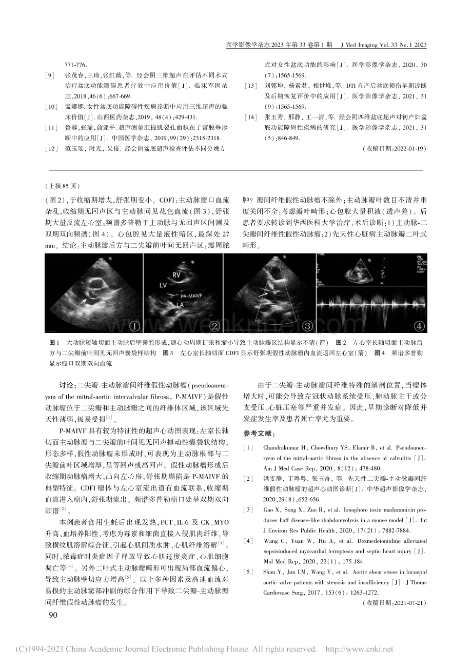 二尖瓣-主动脉瓣间纤维性假性动脉瘤1例_杨铭铭.pdf_第2页