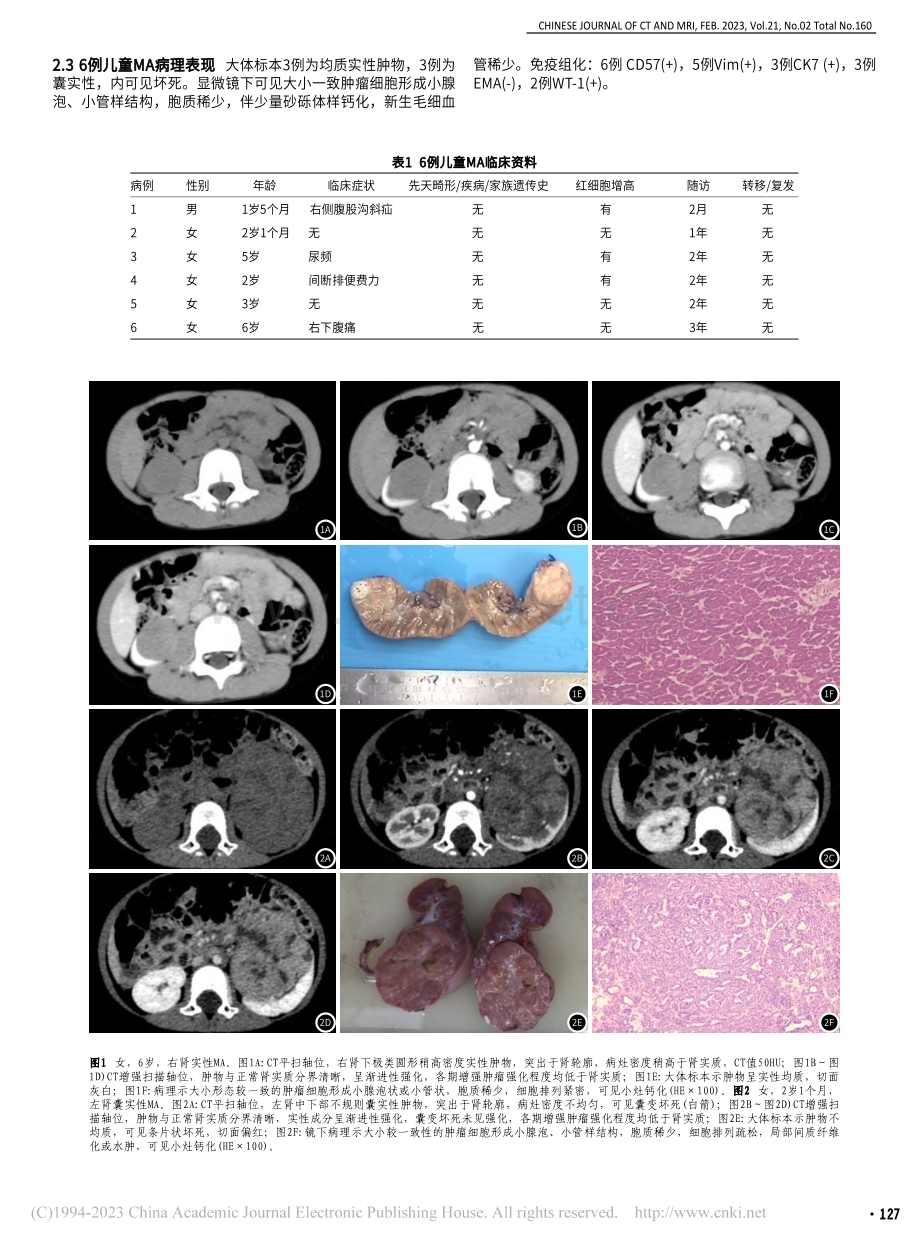 儿童后肾腺瘤的MSCT影像表现_陈希文.pdf_第2页