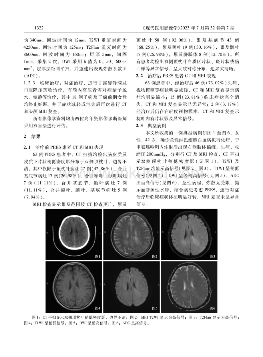 CT、MRI在可逆性后部脑病综合征诊断中的应用分析.pdf_第2页