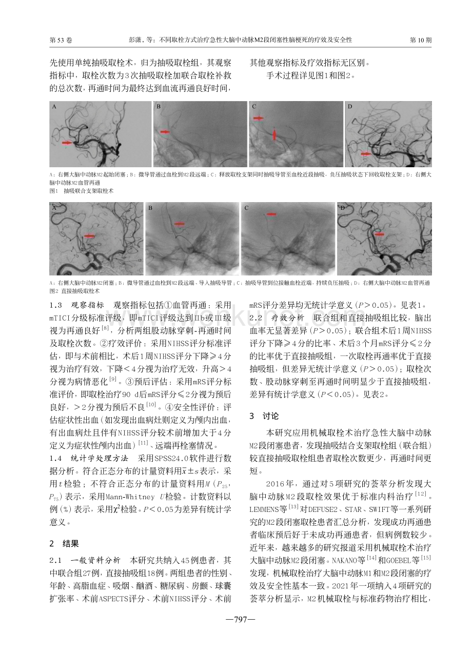 不同取栓方式治疗急性大脑中动脉M2段闭塞性脑梗死的疗效及安全性.pdf_第3页