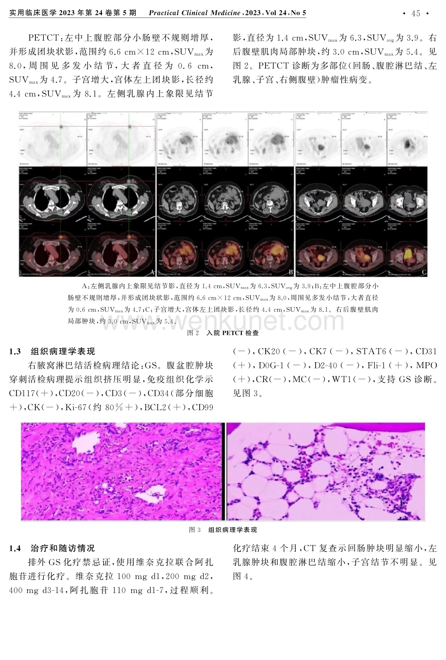 多部位原发性粒细胞肉瘤1例.pdf_第3页