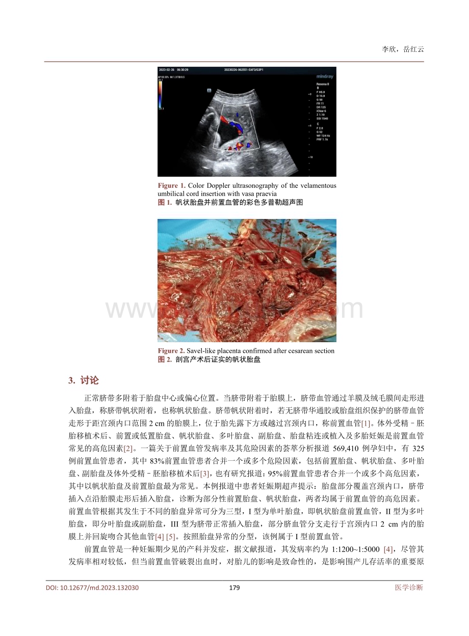 帆状胎盘并前置血管1例及文献复习.pdf_第3页