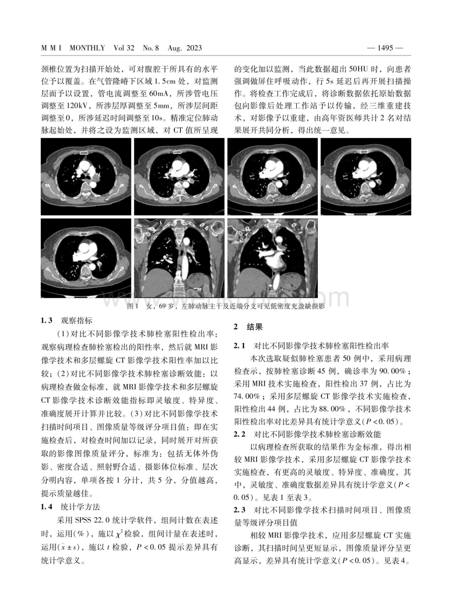 肺栓塞患者行多层螺旋CT诊断的临床应用价值分析.pdf_第2页